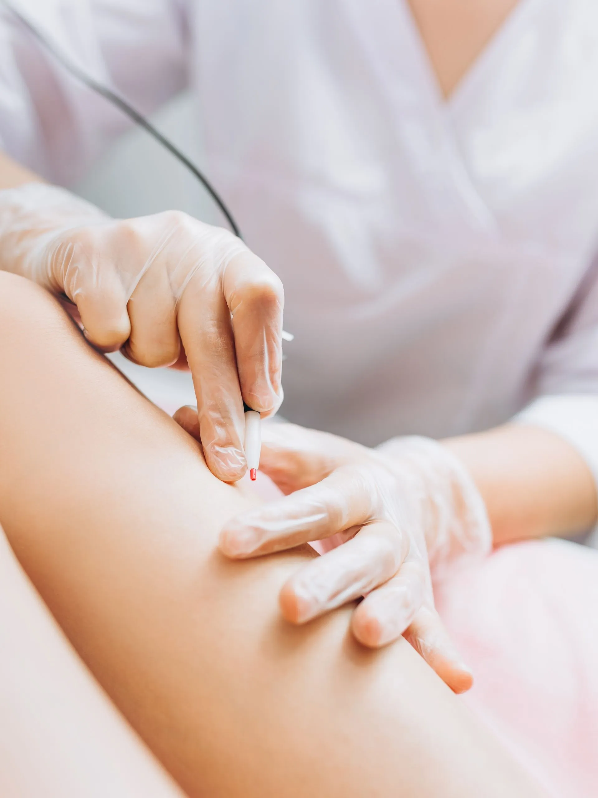 Electrolysis treatment experience at Florida Aesthetics and Wellness Brandon FL