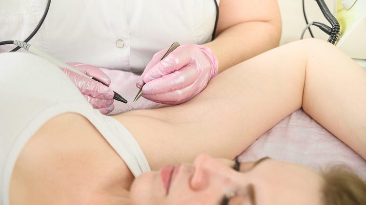 Electrolysis at Florida Aesthetics and Wellness Brandon FL