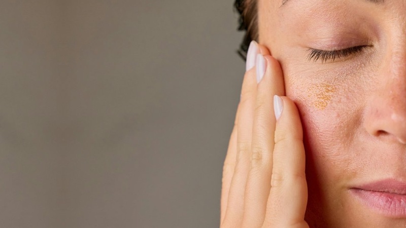 Enlarged pores treatment Brandon FL