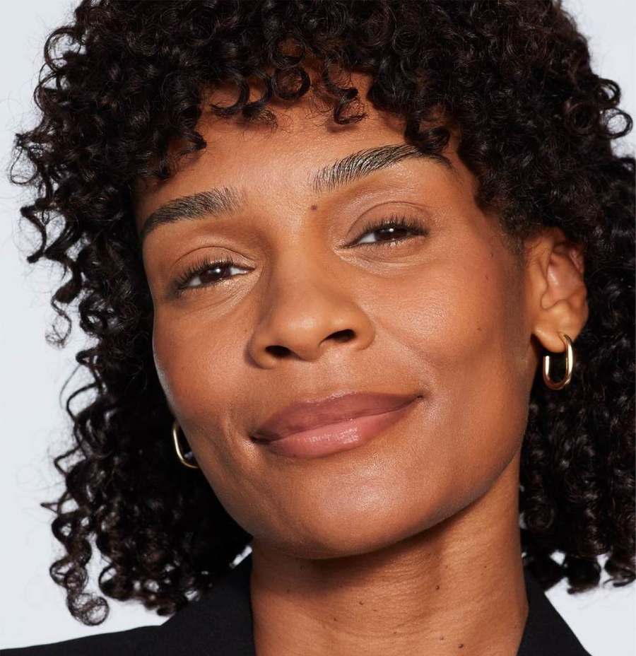 Juvéderm Volux XC, jawline and chin