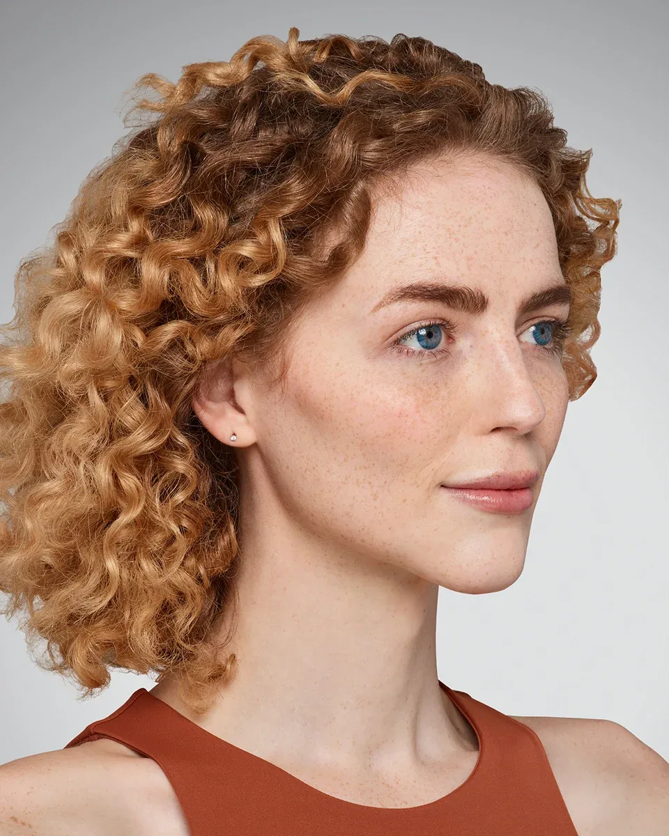 Addieson after Juvéderm Ultra XC lip filler, natural volume enhancement