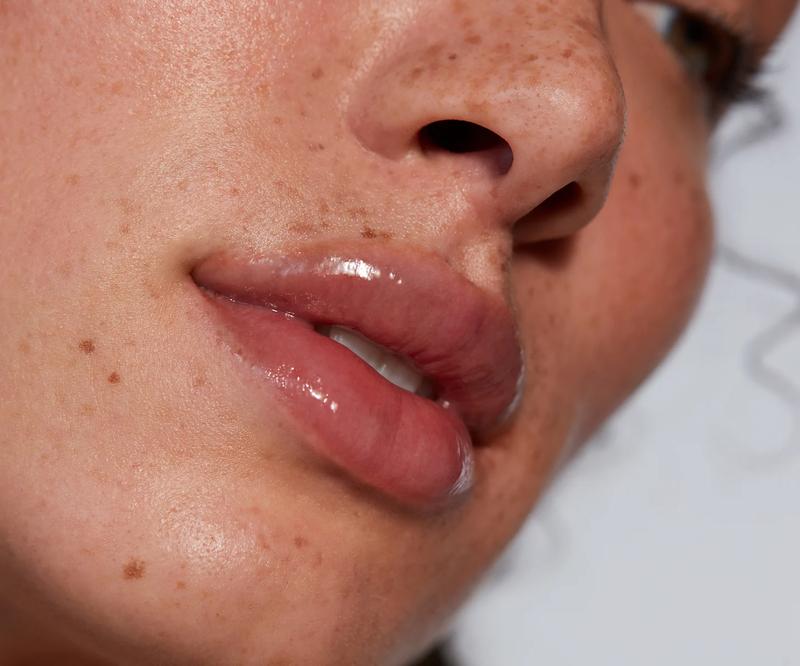 Volbella lip filler appointment experience at Florida Aesthetics and Wellness