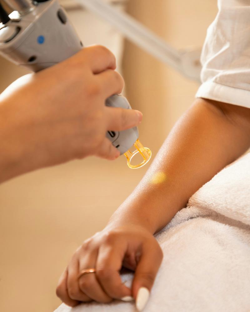 Laser hair removal treatment experience at Florida Aesthetics and Wellness Brandon FL
