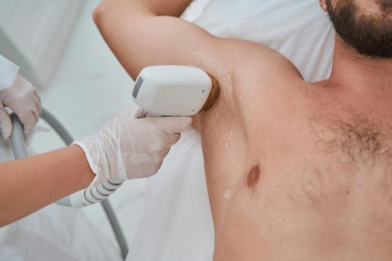 Laser hair removal for men at Florida Aesthetics and Wellness Brandon FL