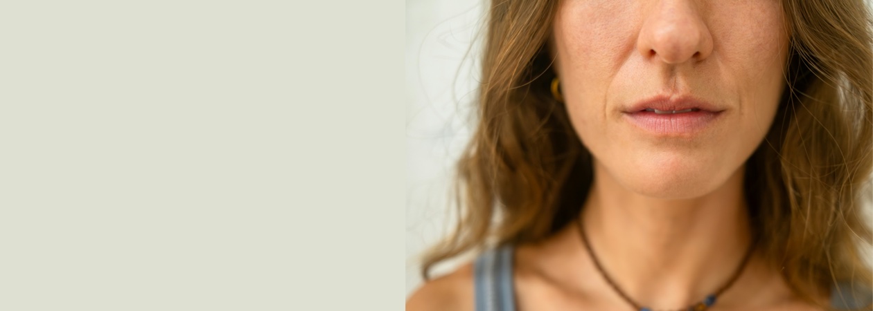Dermal filler treatment for nasolabial folds at Florida Aesthetics and Wellness Brandon FL