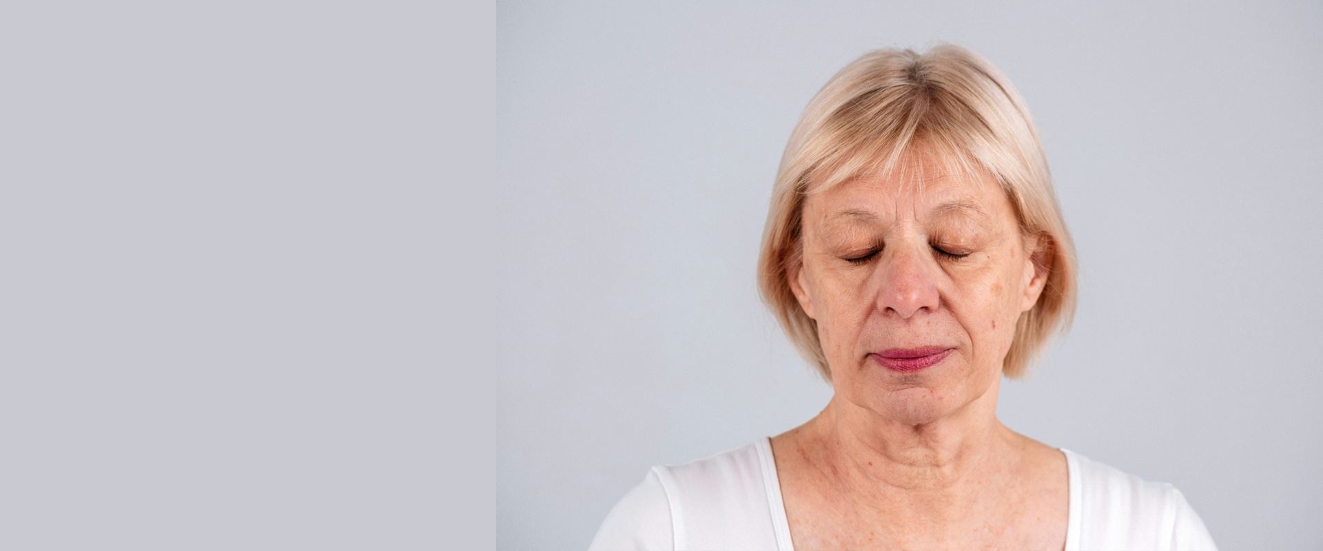 Concerns Nasalabial Folds at Florida Aesthetics and Wellness Brandon FL