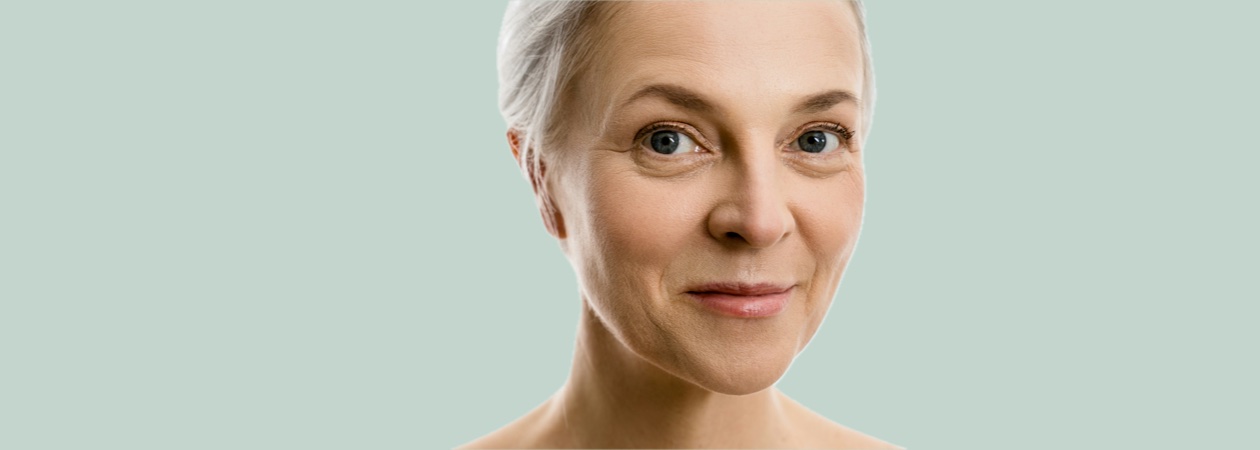 Nasolabial folds smile lines treatment Brandon FL