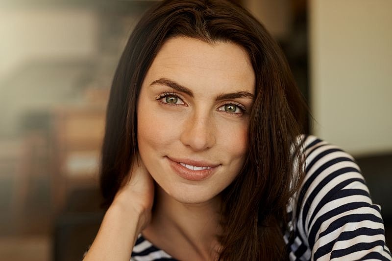 RADIESSE® filler treatment at Florida Aesthetics and Wellness Brandon FL