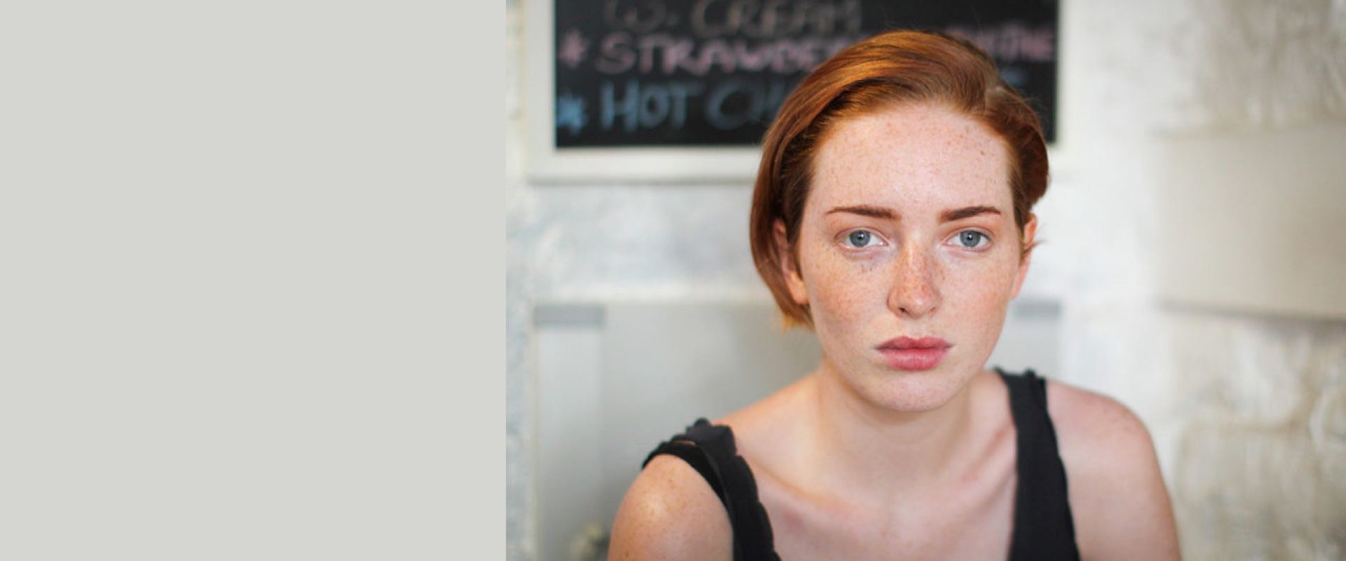 Redness and rosacea treatment at Florida Aesthetics and Wellness Brandon FL