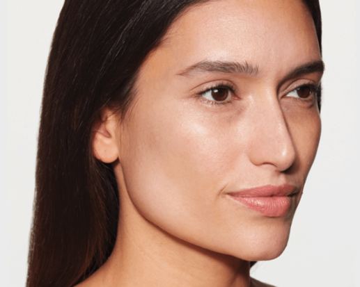 Sculptra® Aesthetic collagen stimulator treatment at Florida Aesthetics and Wellness Brandon FL