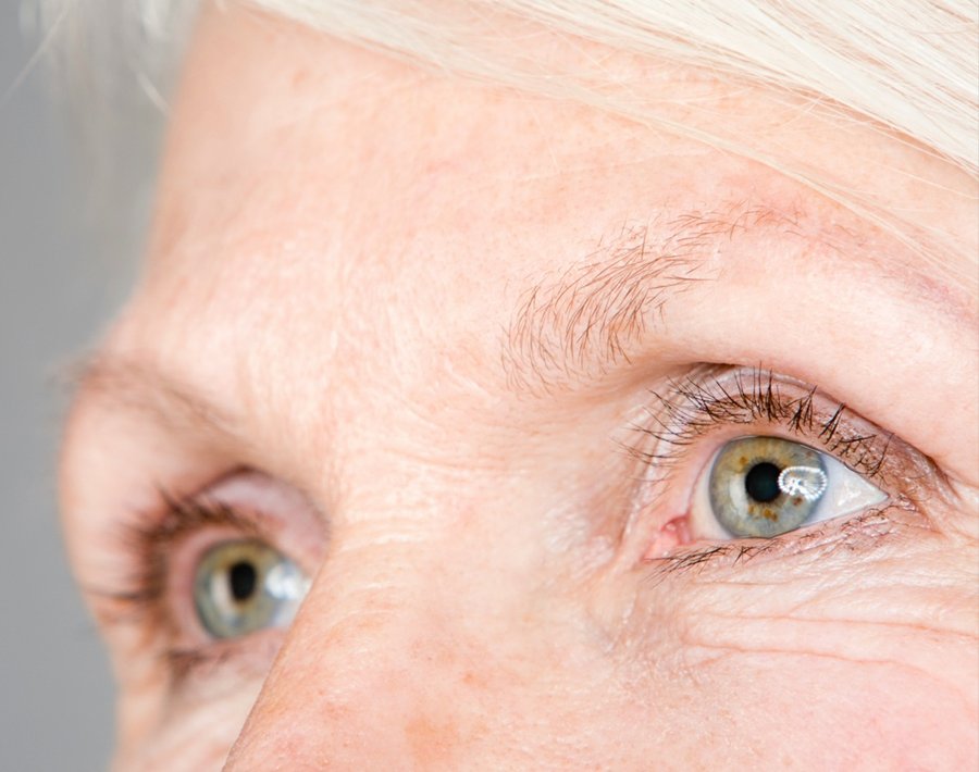 Close-up of bright, open eyes after Upneeq prescription eye drops at Florida Aesthetics & Wellness in Brandon, FL
