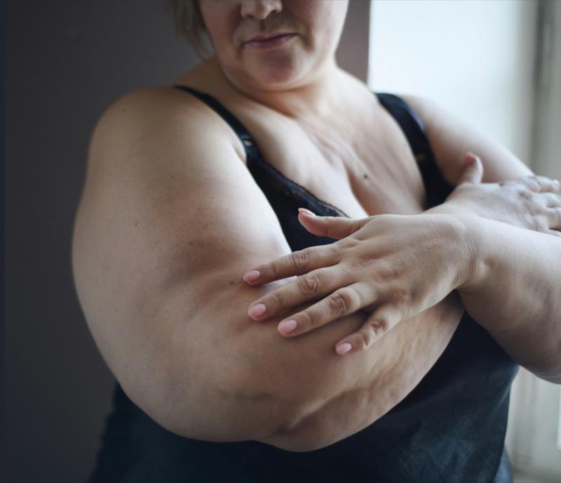 Medical weight loss program Florida Aesthetics and Wellness Brandon FL
