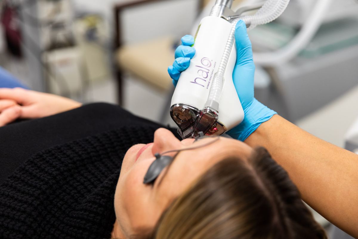 BBL HEROic and MOXI laser skin rejuvenation at Florida Aesthetics and Wellness Brandon FL