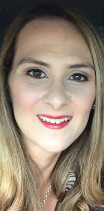 Before BBL and MOXI before and after at Florida Aesthetics and Wellness in Brandon, FL